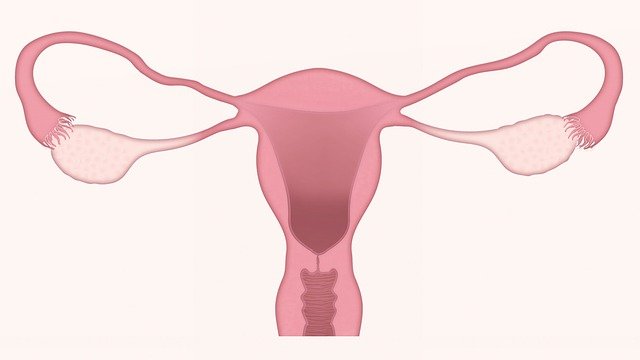 Uterus andometriose